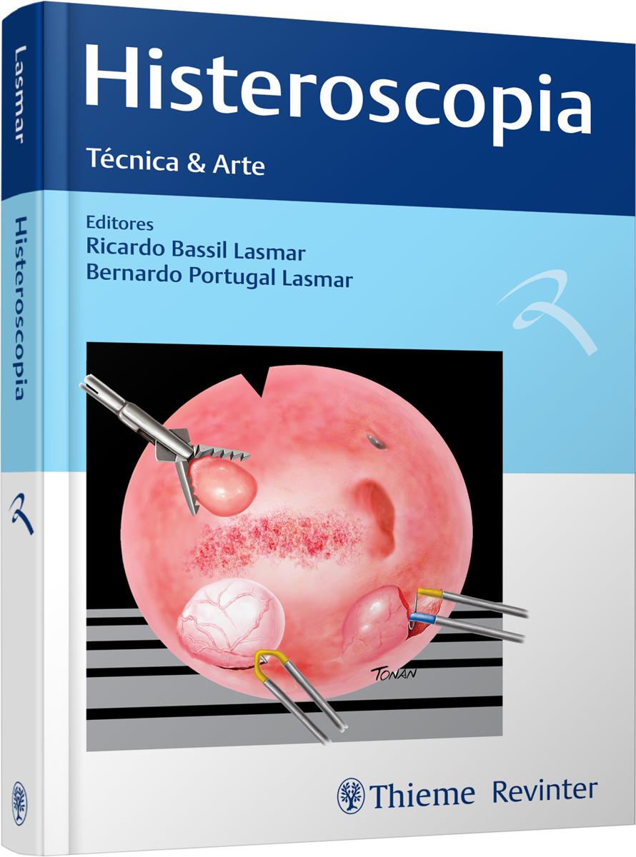 Livro Histeroscopia Técnica & Arte